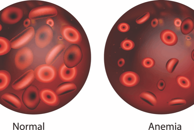 Ενδοσκοπική Κάψουλα για τον έλεγχο λεπτού εντέρου
