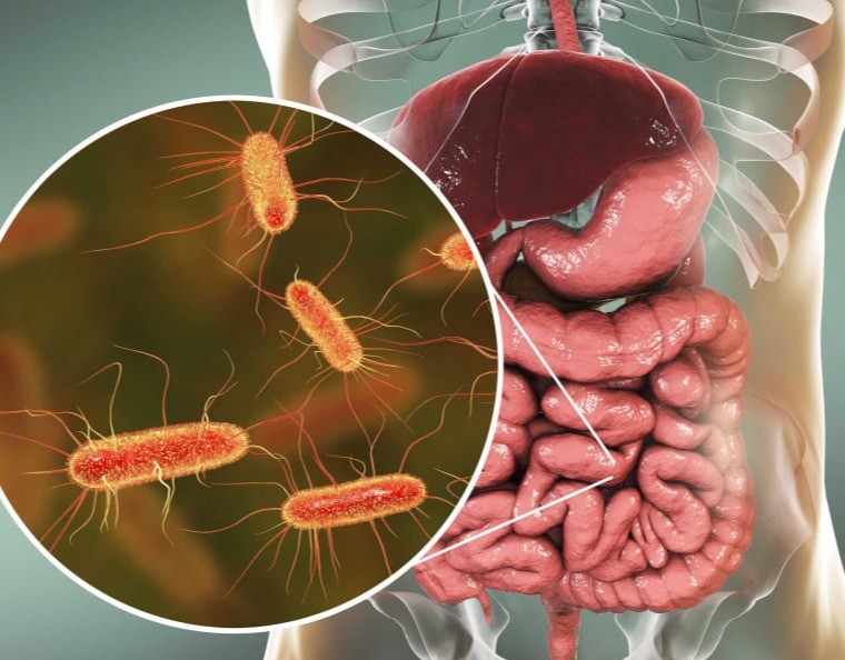 Βακτηριακή υπερανάπτυξη λεπτού εντέρου SIBO