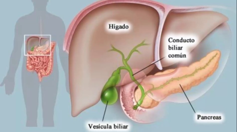 Πρωτοπαθής χολική χολαγγειίτιδα