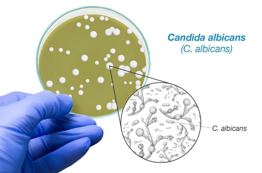 Candida