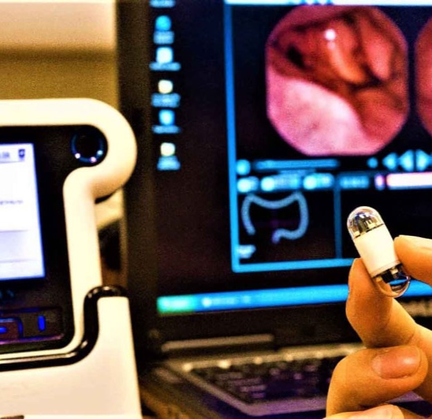 Ενδοσκοπική Κάψουλα για τον έλεγχο γαστροοισοφαγικής παλινδρόμησης