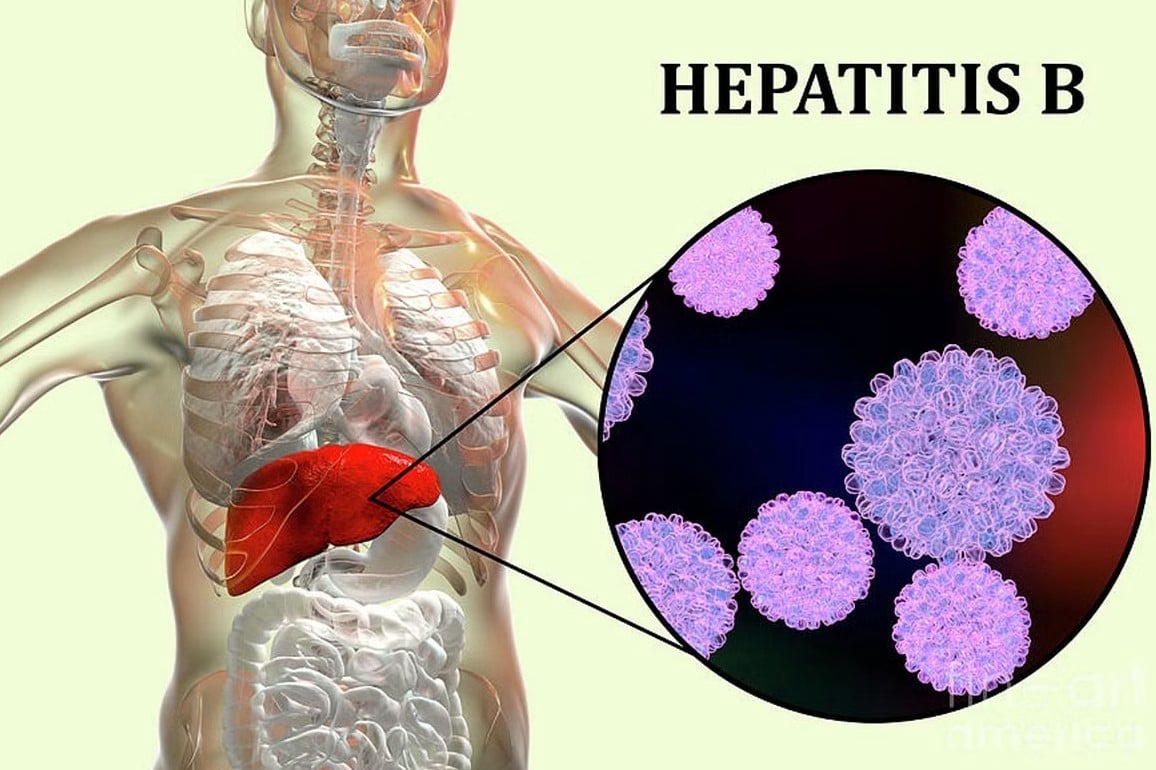 Ηπατίτιδα Β