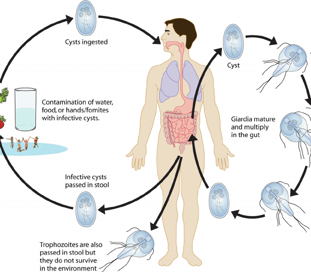 Λαμβλίαση (Λοίμωξη από Giardia lamblia)