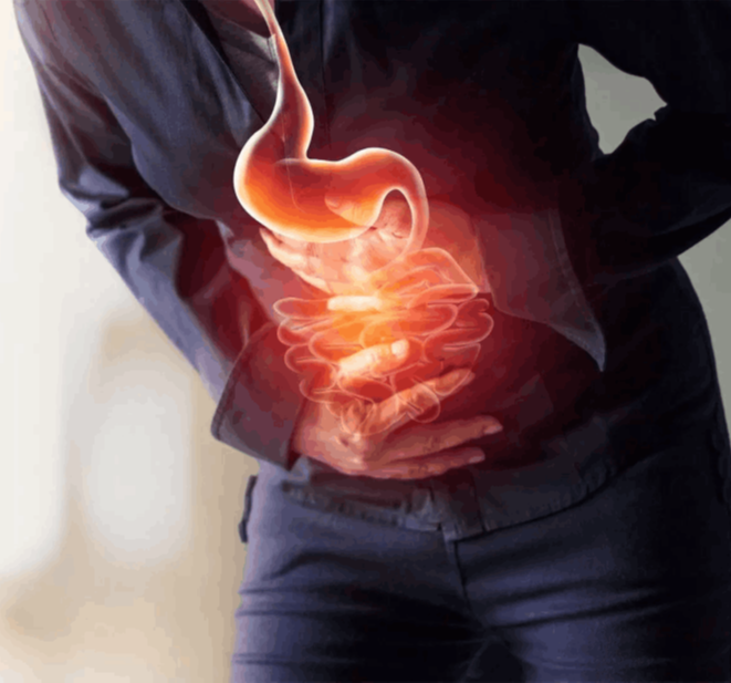 Ευερέθιστο έντερο (σπαστική κολίτιδα)