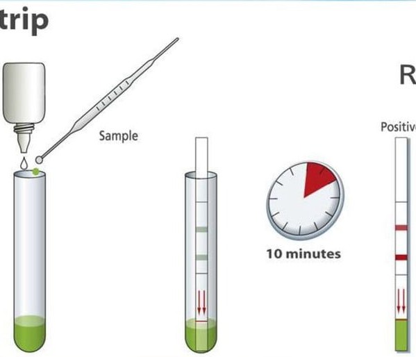 Τεστ αντιγόνου Ελικοβακτηριδίου του πυλωρού στα κόπρανα